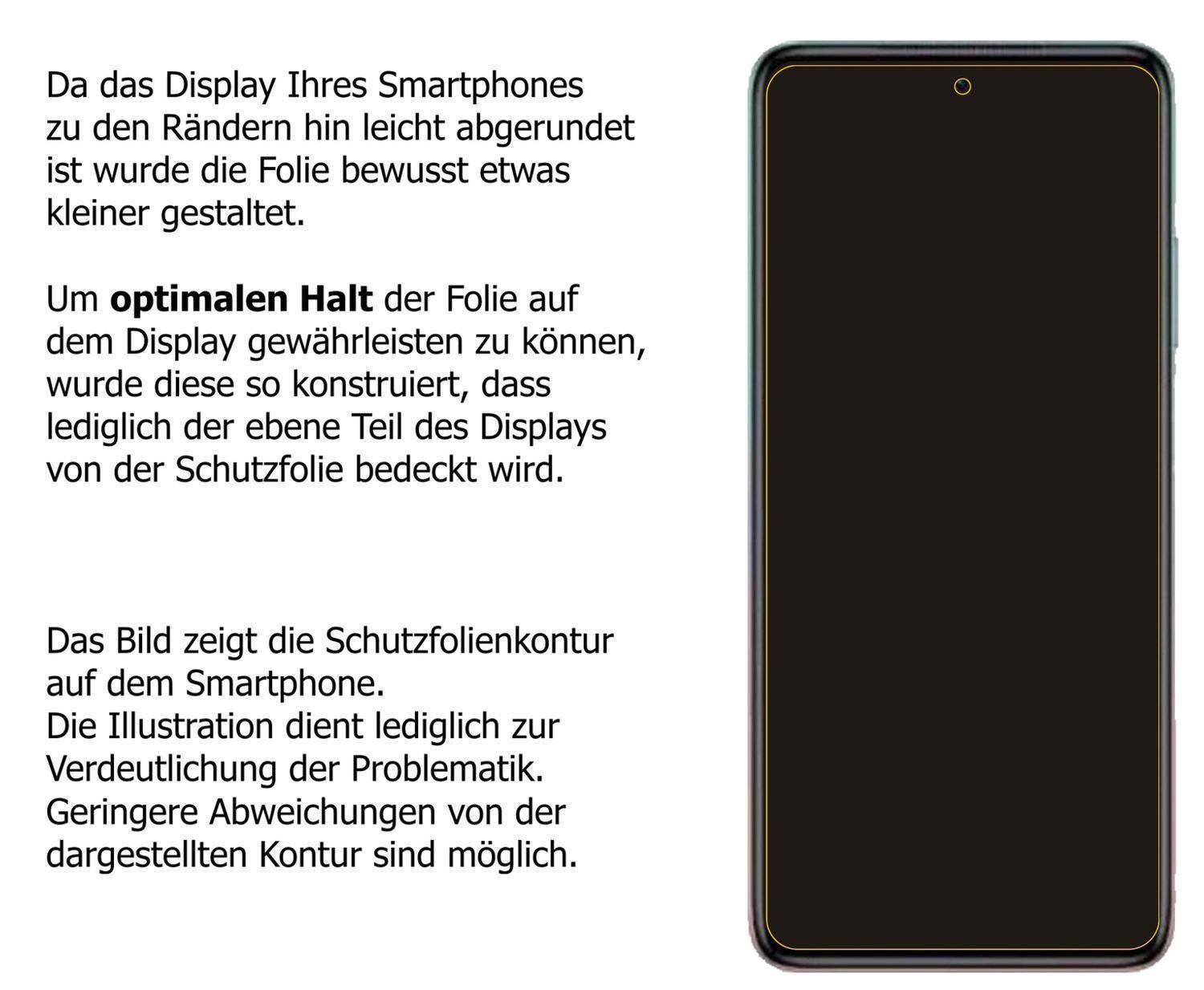 Blickschutzfolie für Xiaomi Redmi Note 11T matt Sc (5)